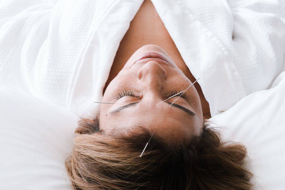 Carillon wellness retreat spa acupuncture